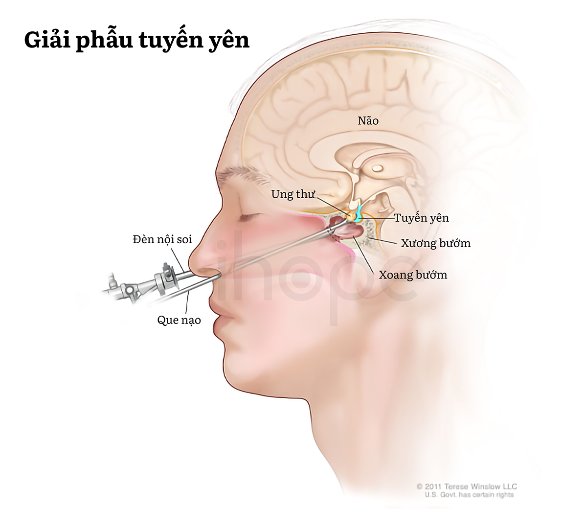 Giải Phẫu Tuyến Yên