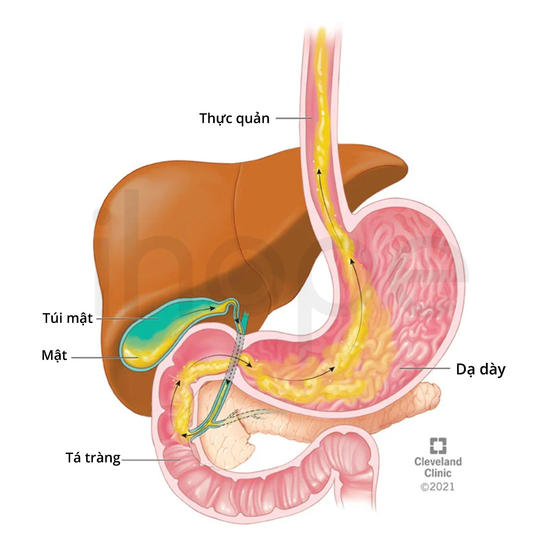 Trạo-ngược-mật