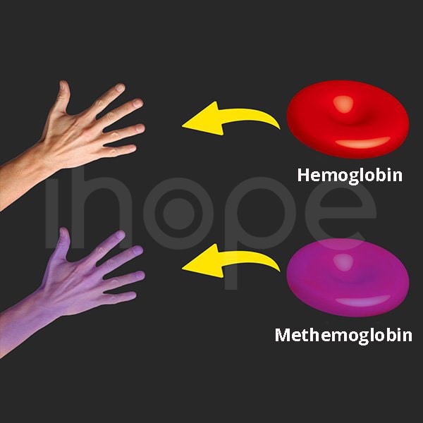 methemoglobin-min