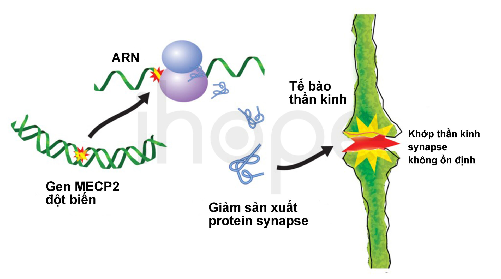 Đột Biến Gen Mecp2 Làm Giảm Lượng Protein Cần Thiết Cho Hoạt động Của Khớp Thần Kinh.