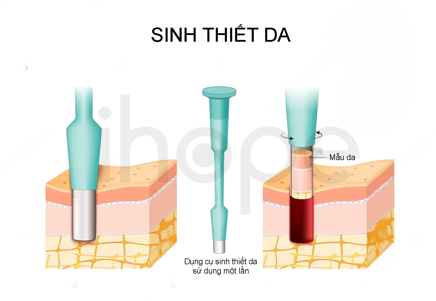 Sinh Thiết Da