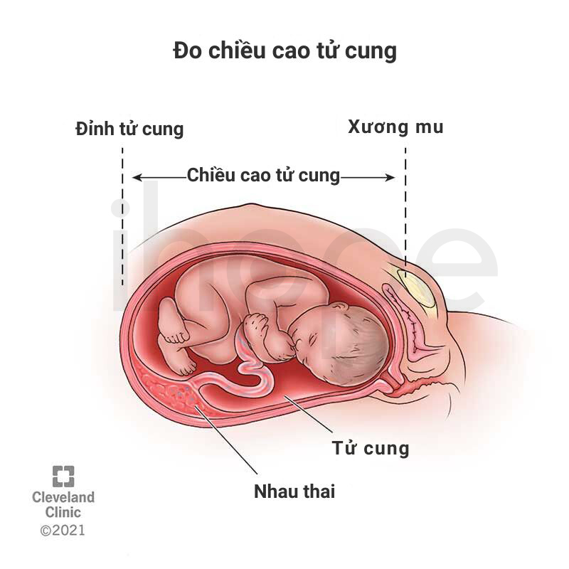 Đo Chiều Cao Tử Cung 1