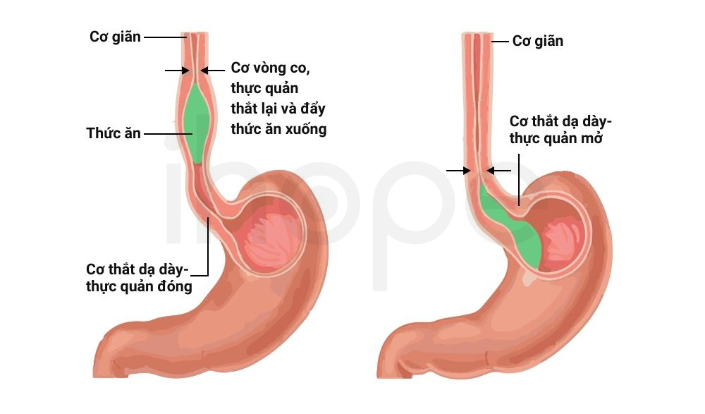 Nhu động Tại Thực Quản Dạ Dày 1