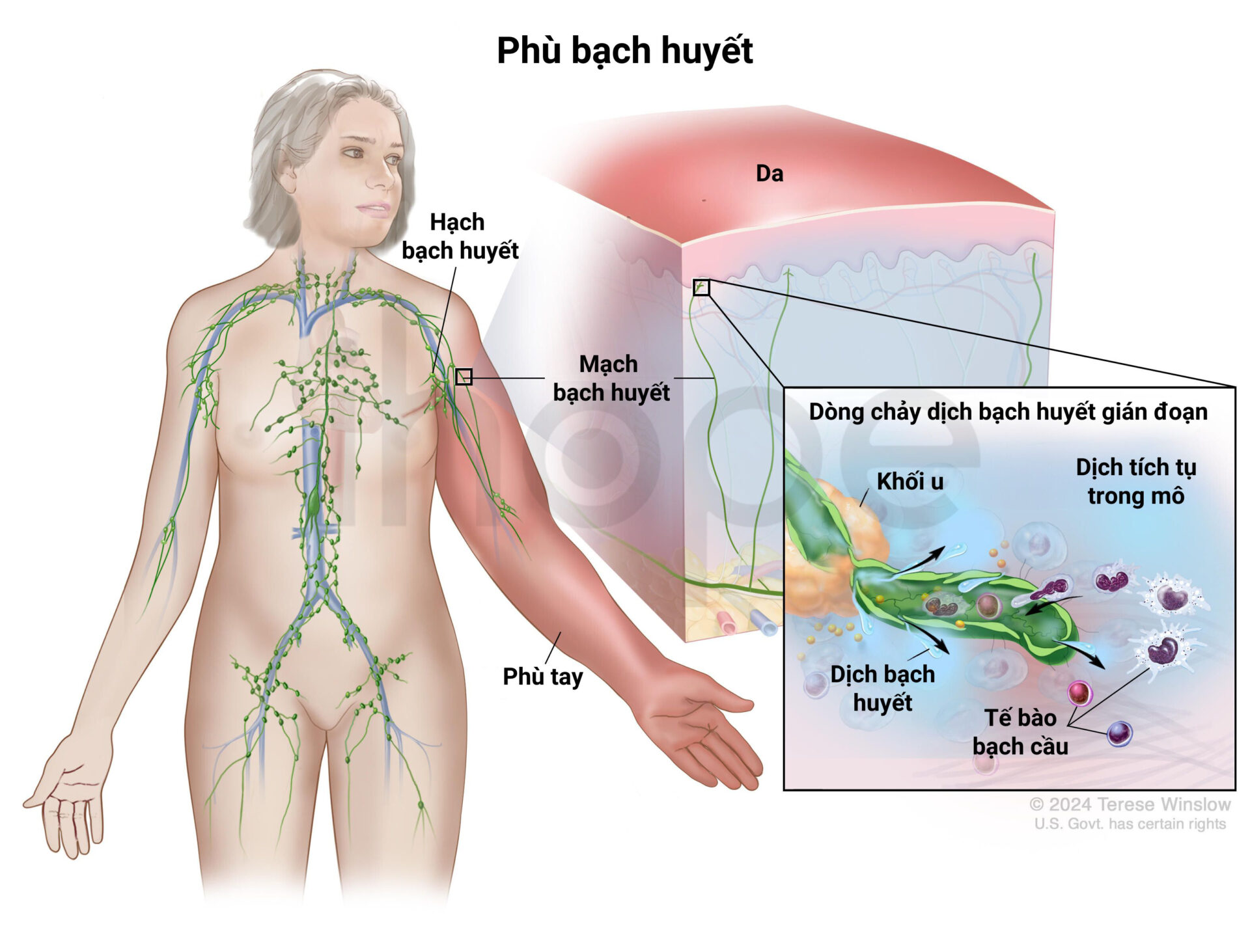 Phù Bạch Huyết