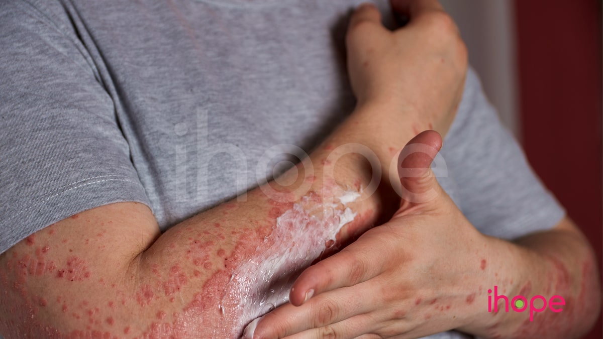 Bạch Cầu ái Toan Mãn Tính Min