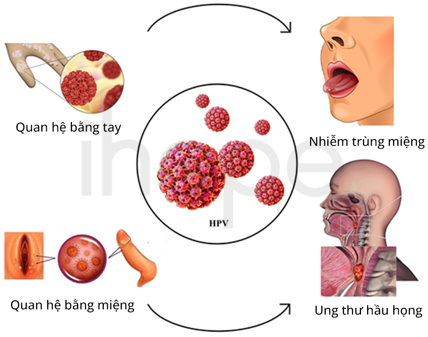 Các Hình Thức Lây Bệnh Hpv