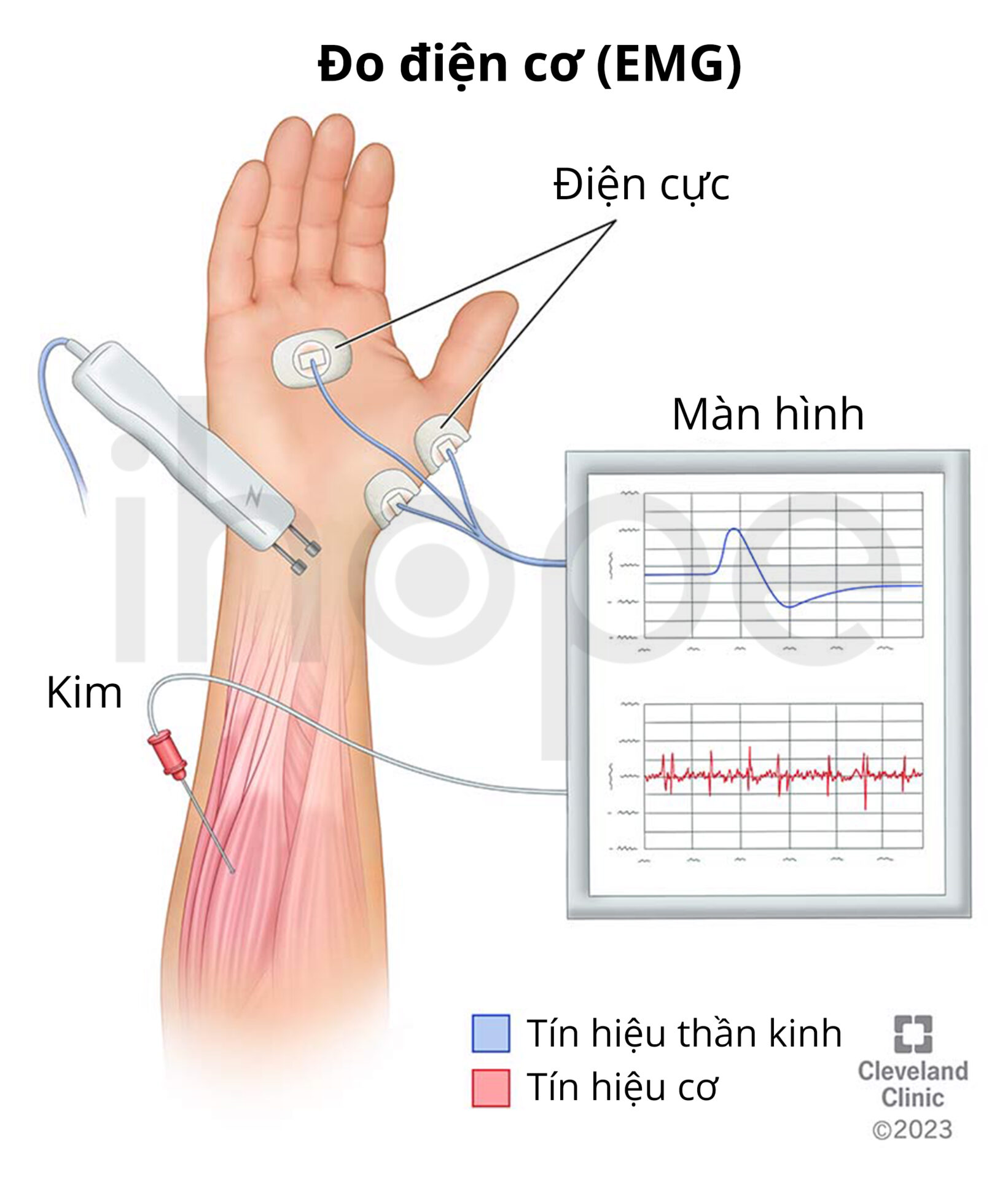 đo điện Cơ