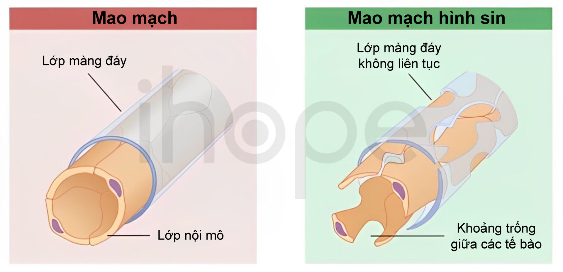 Mao Mạch Và Mao Mạch Hình Sin (1)