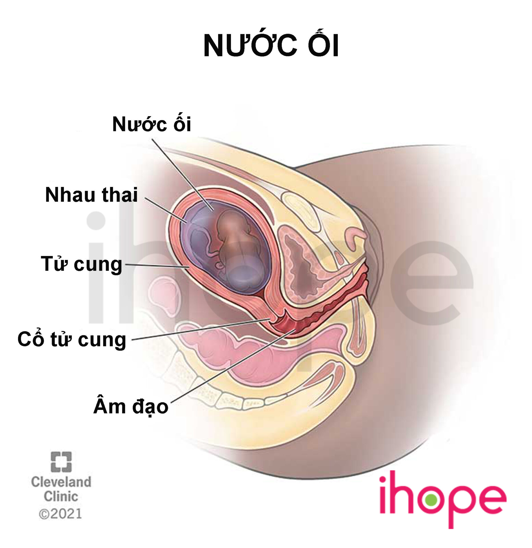 Nước ối