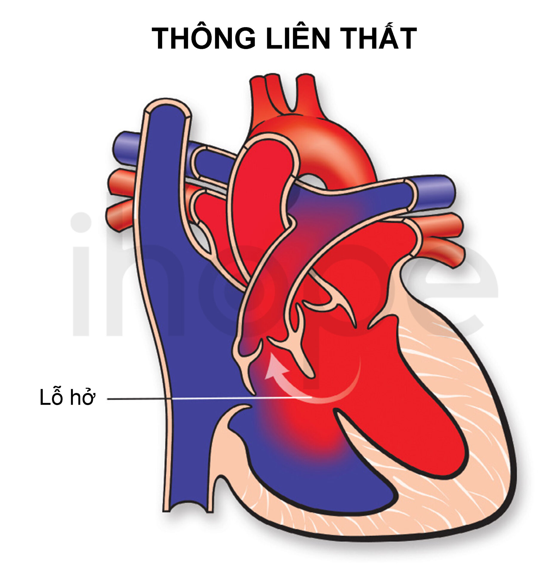 Thông Liên Thất