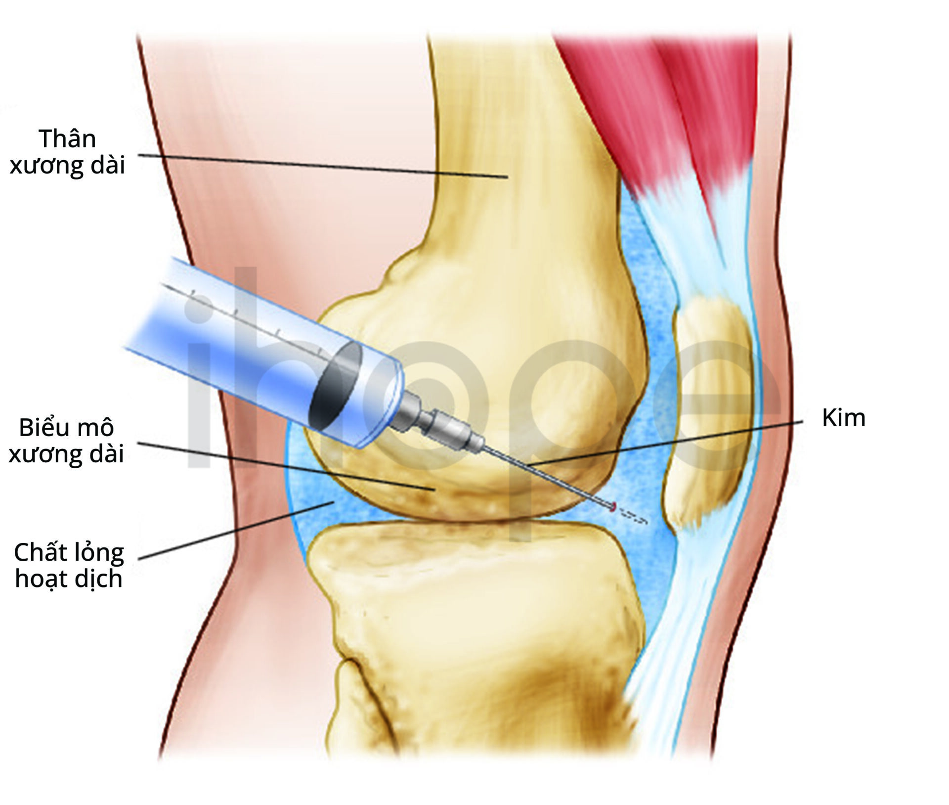 Xét Nghiệm Dịch Khớp