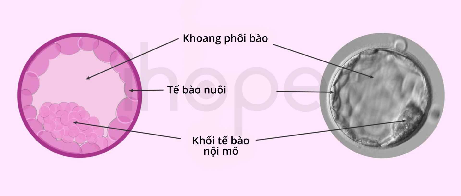 Cấu Trúc Phôi Nang