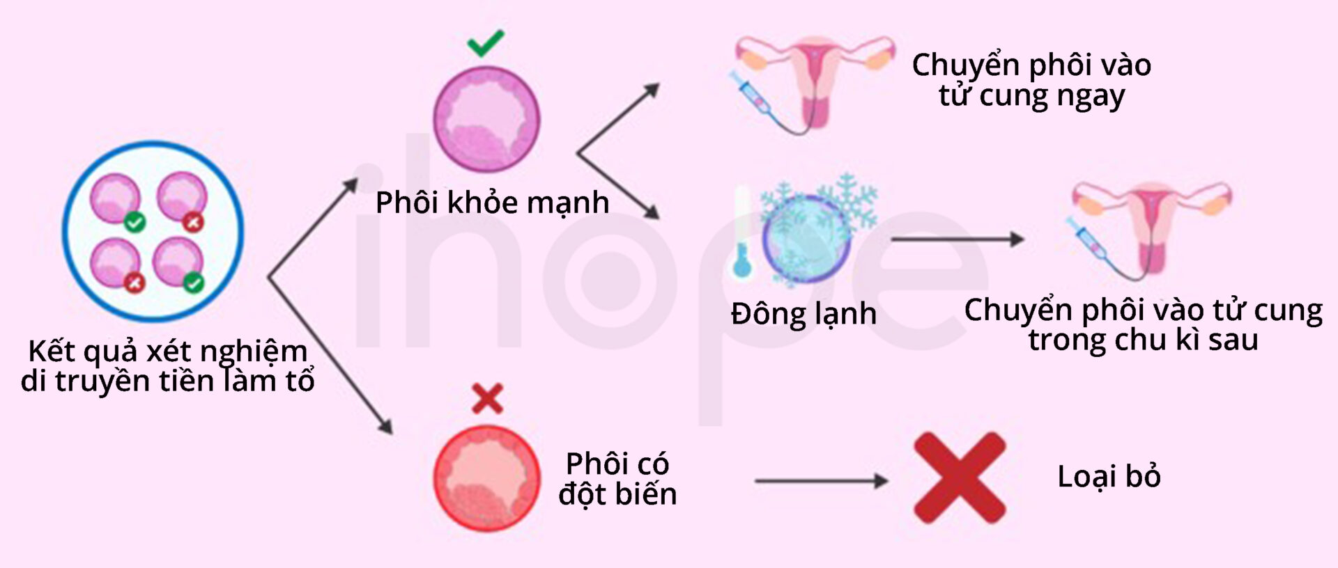 Chuyển Phôi Vào Tử Cung