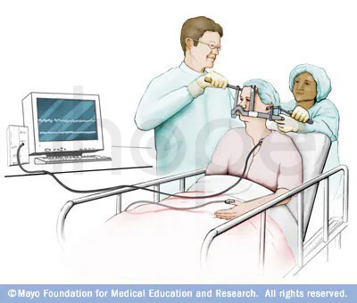Khung Cố định đầu Trong Phương Pháp Xạ Phẫu định Vị Bằng Máy Gamma Knife