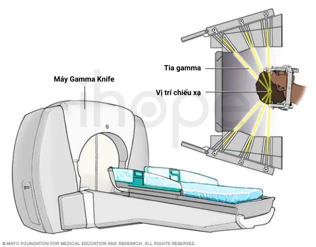 Máy Gamma Knife 1