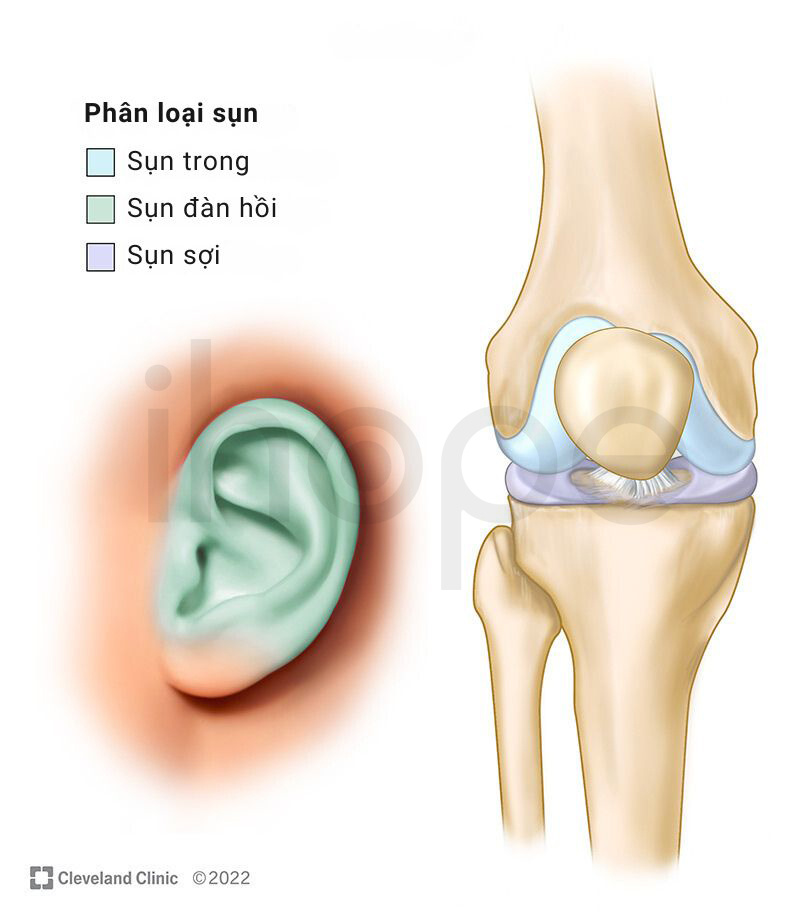 Phân Loại Sụn 1