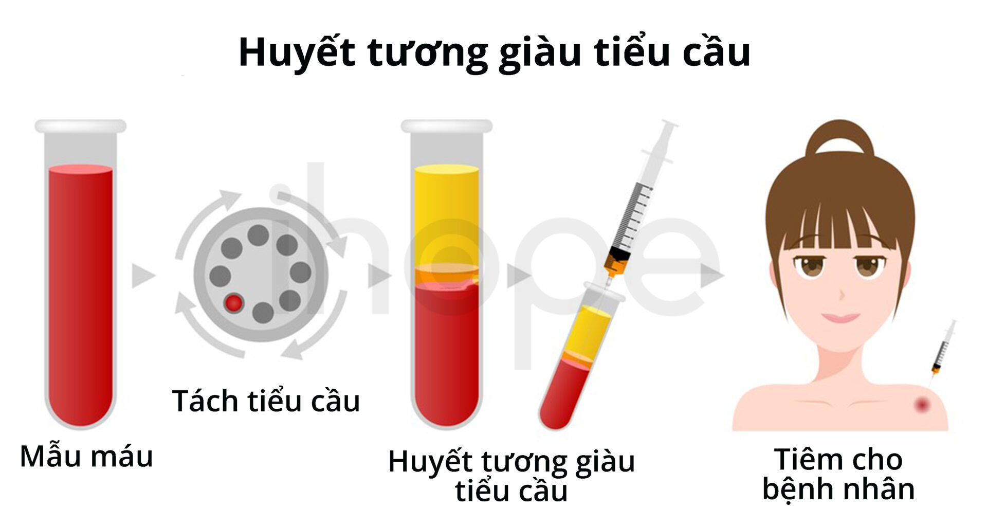 Quy Trình Sản Xuất Huyết Tương Giàu Tiểu Cầu