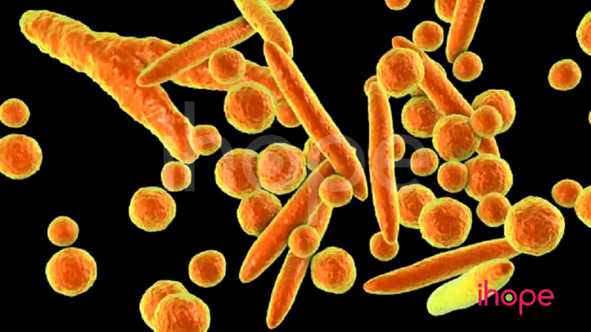 Vi Khuẩn Mycoplasma Hominishominis Min