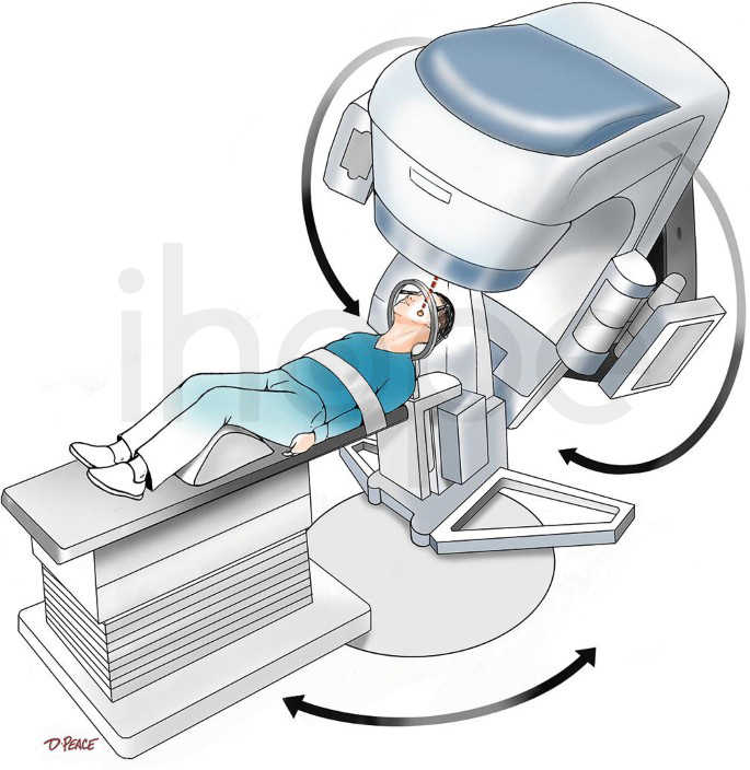 Xạ Phẫu định Vị Bằng Máy Gia Tốc Tuyến Tính