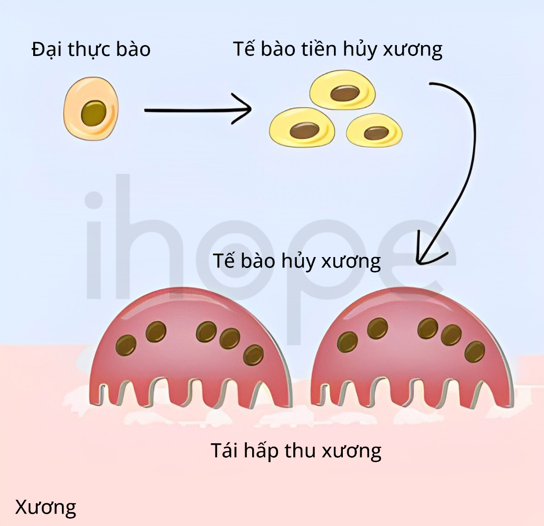 Kích Hoạt Tế Bào Hủy Xương (1)