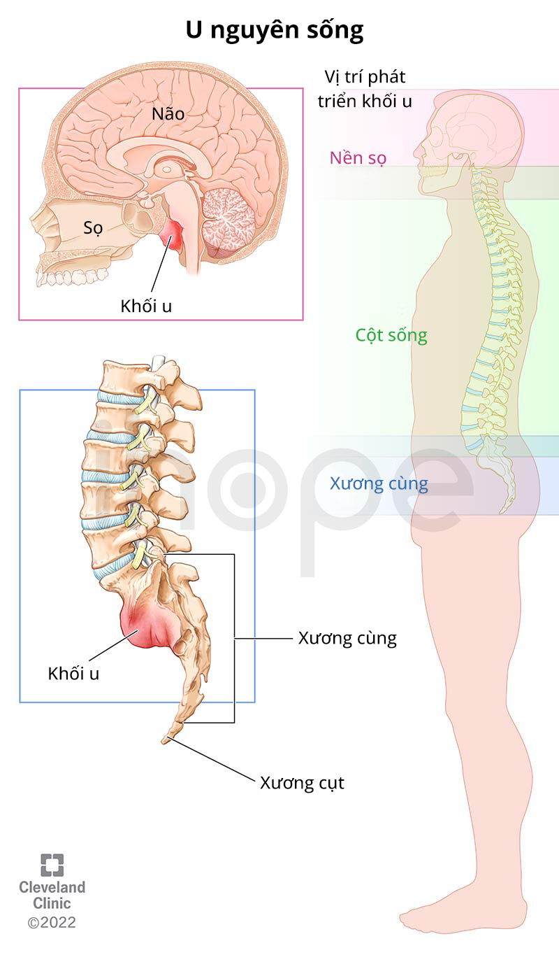 Vị Trí Phát Triển U Nguyên Sống