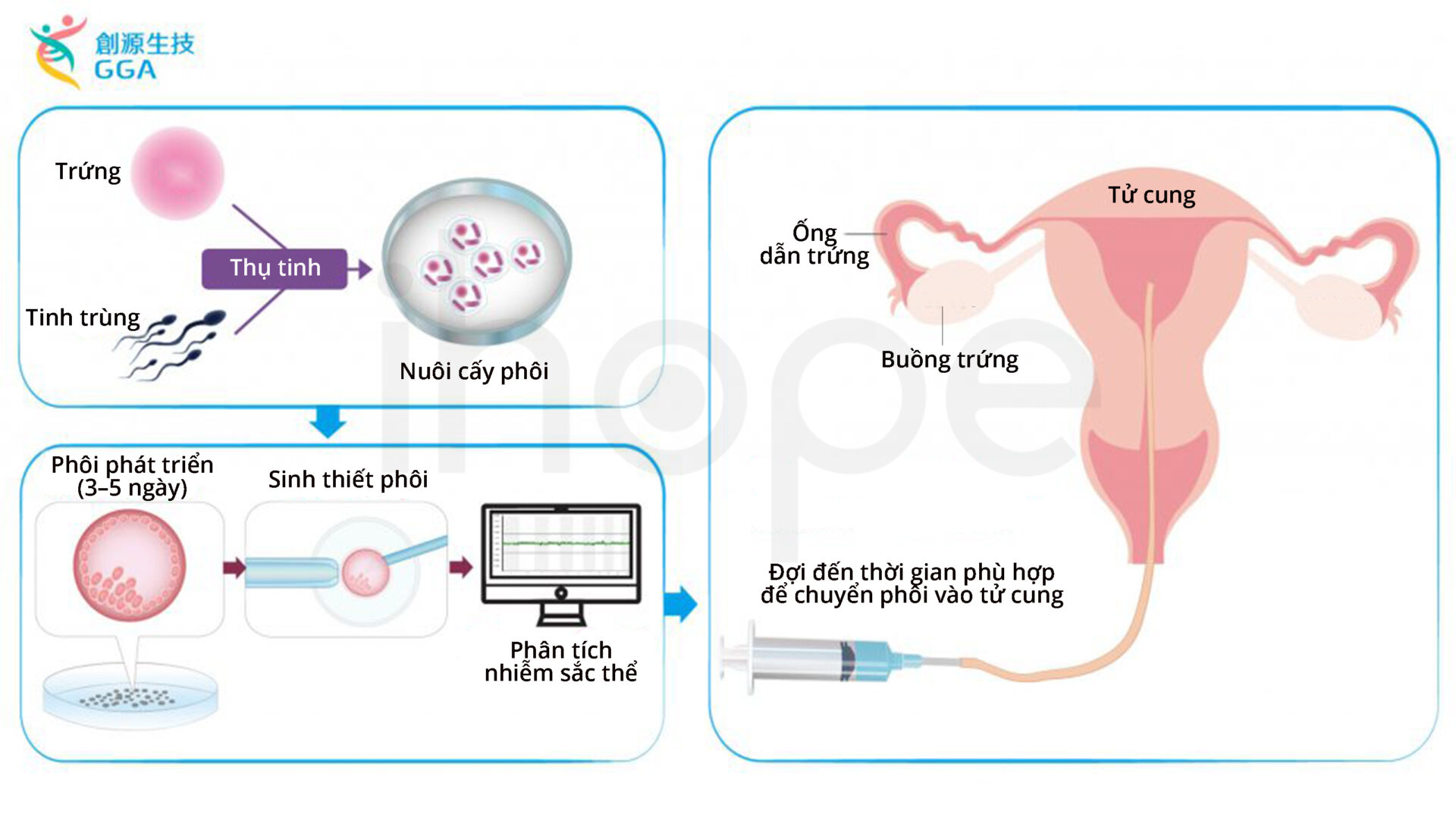 Xét Nghiệm Di Truyền Tiền Làm Tổ để Phát Hiện Tình Trạng Lệch Bội Nst Trong Phôi