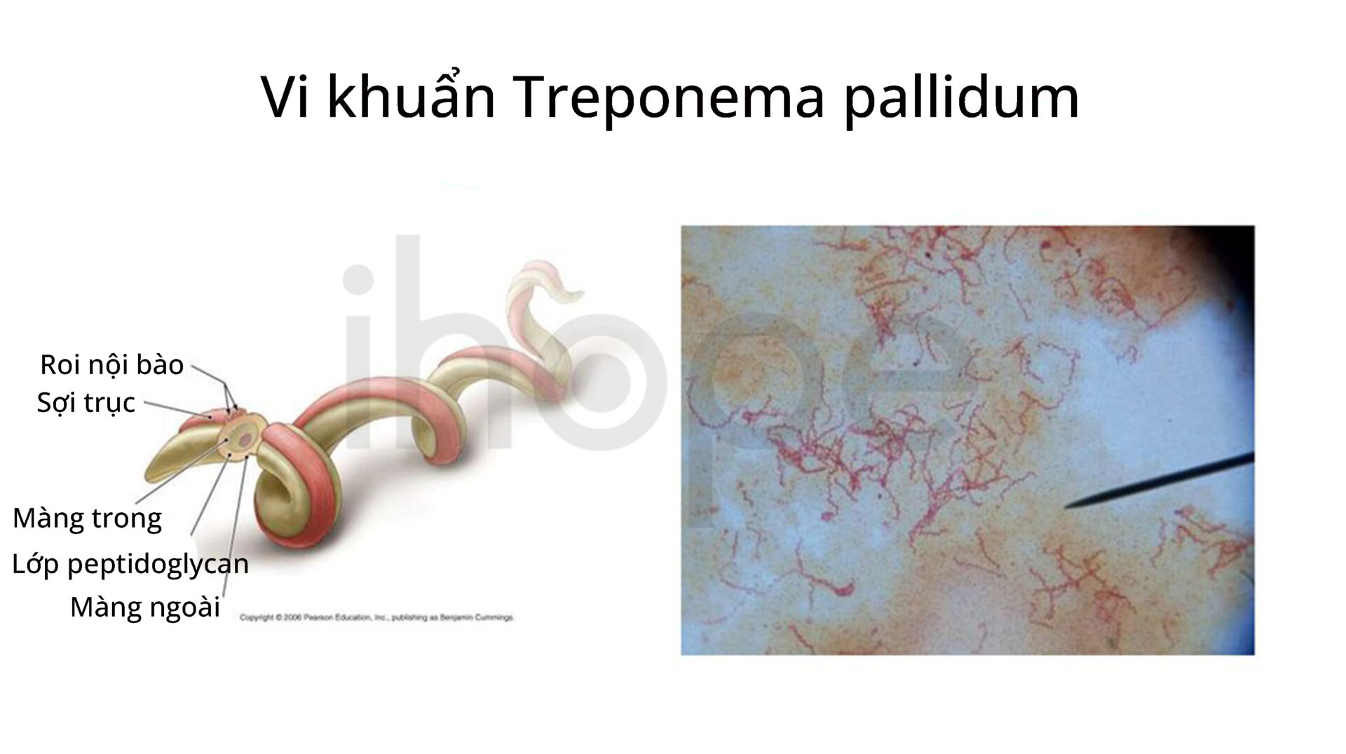 Cấu Trúc Của Vi Khuẩn Treponema Pallidum