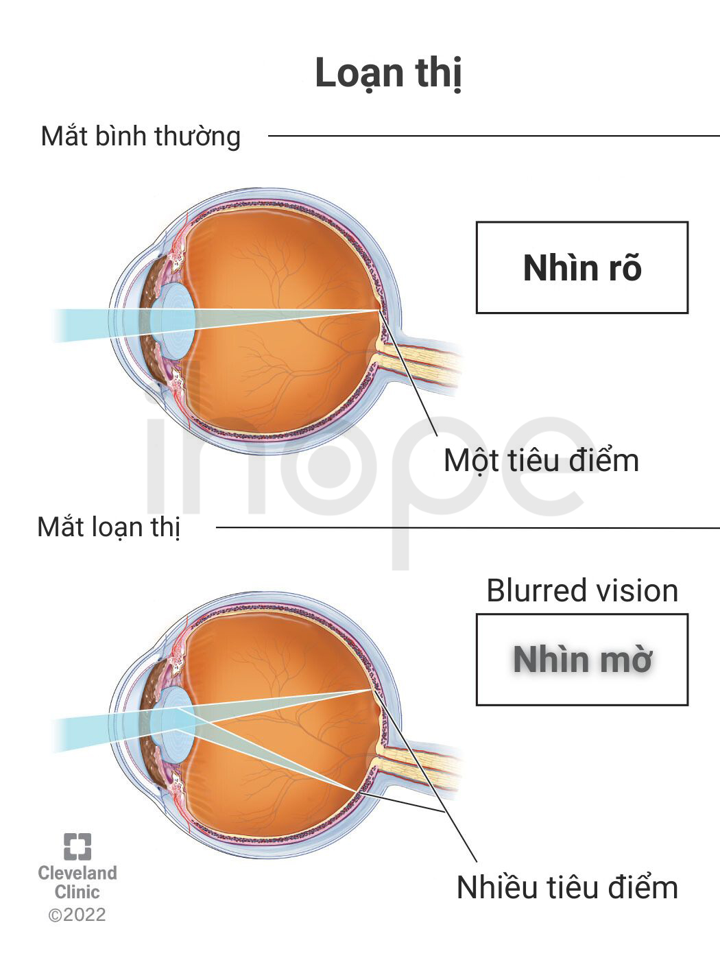 Loạn Thị 1