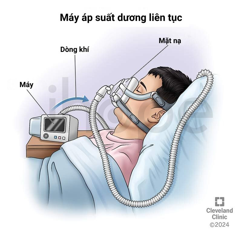 Máy áp Suất Dương Liên Tục 1