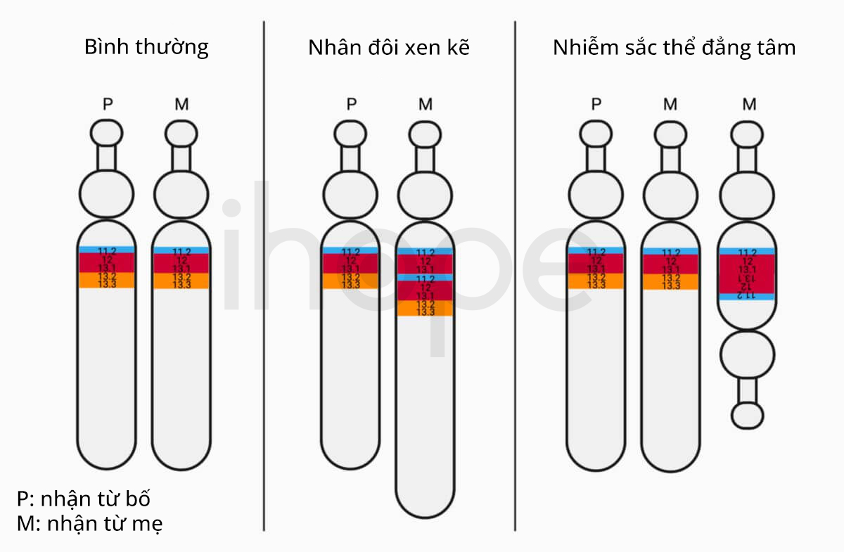 Nhiễm Sắc Thể đẳng Tâm