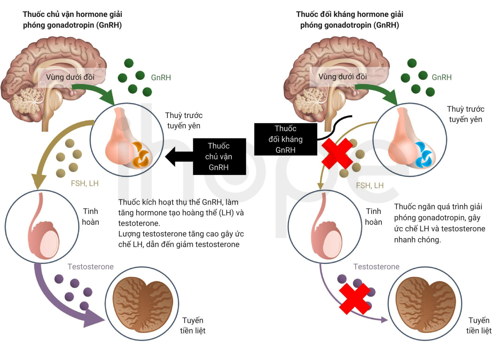 Thuốc Chủ Vận Và đối Kháng Gnrh