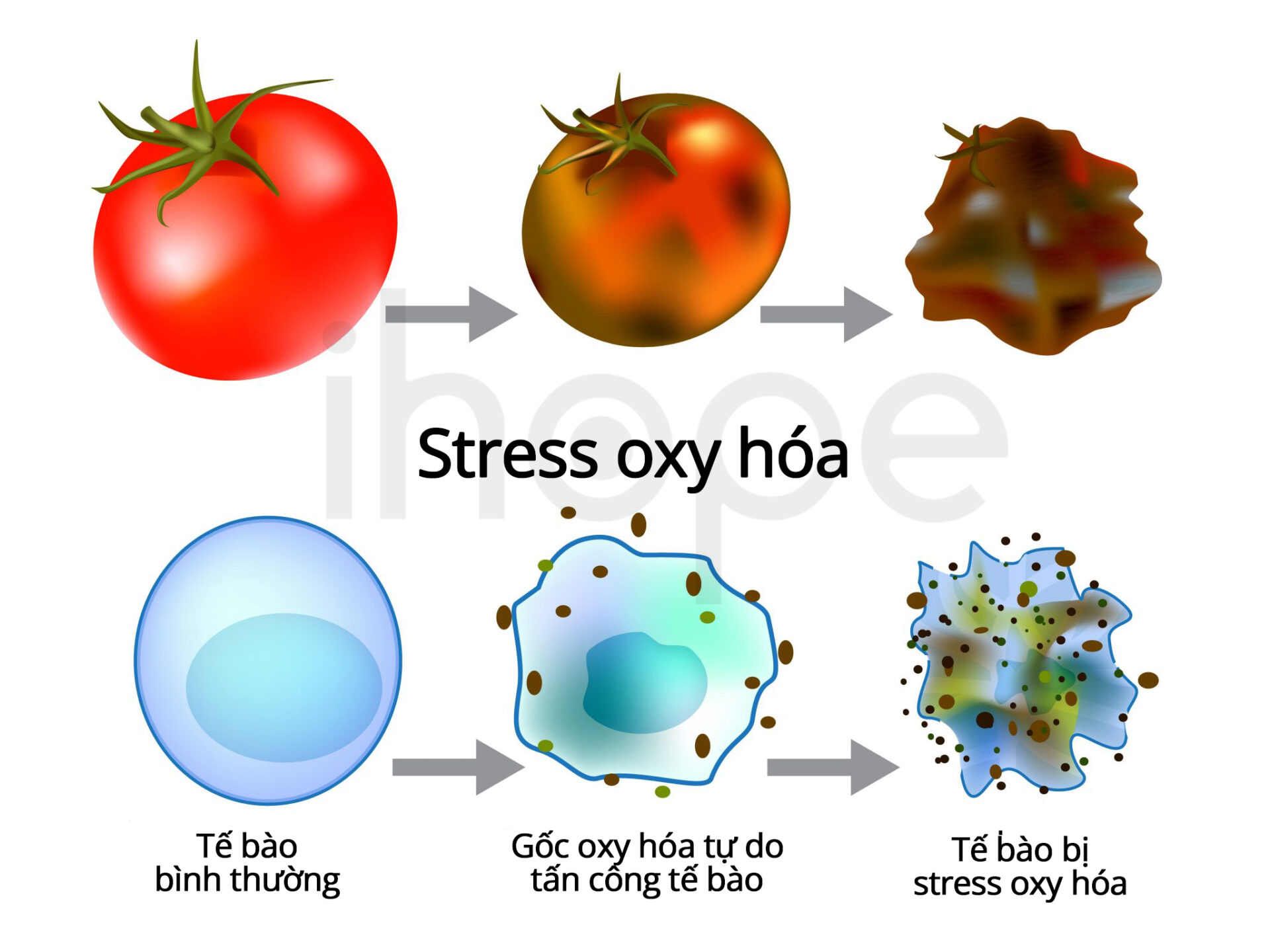 Stress Oxy Hóa