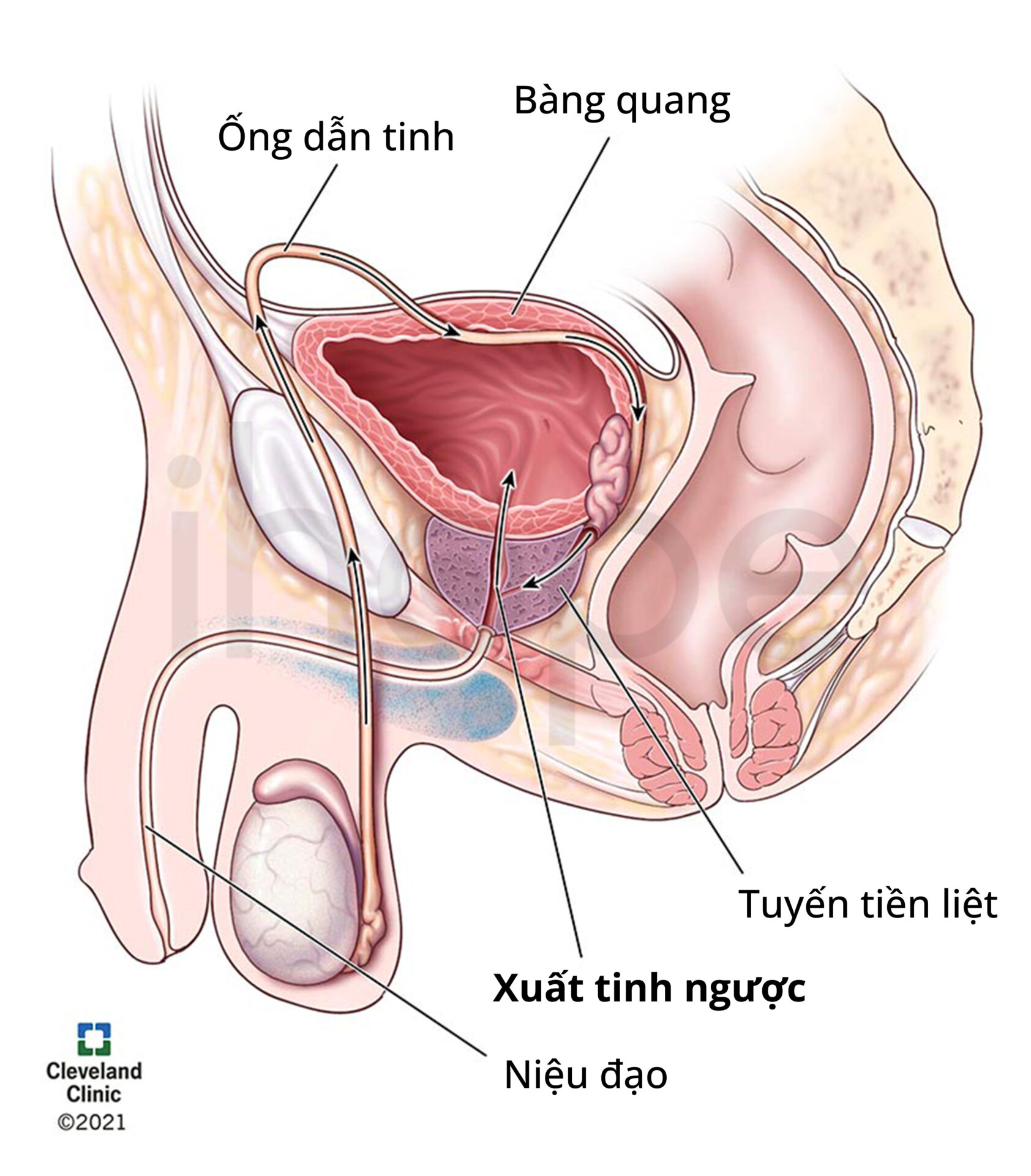 Xuất Tinh Ngược