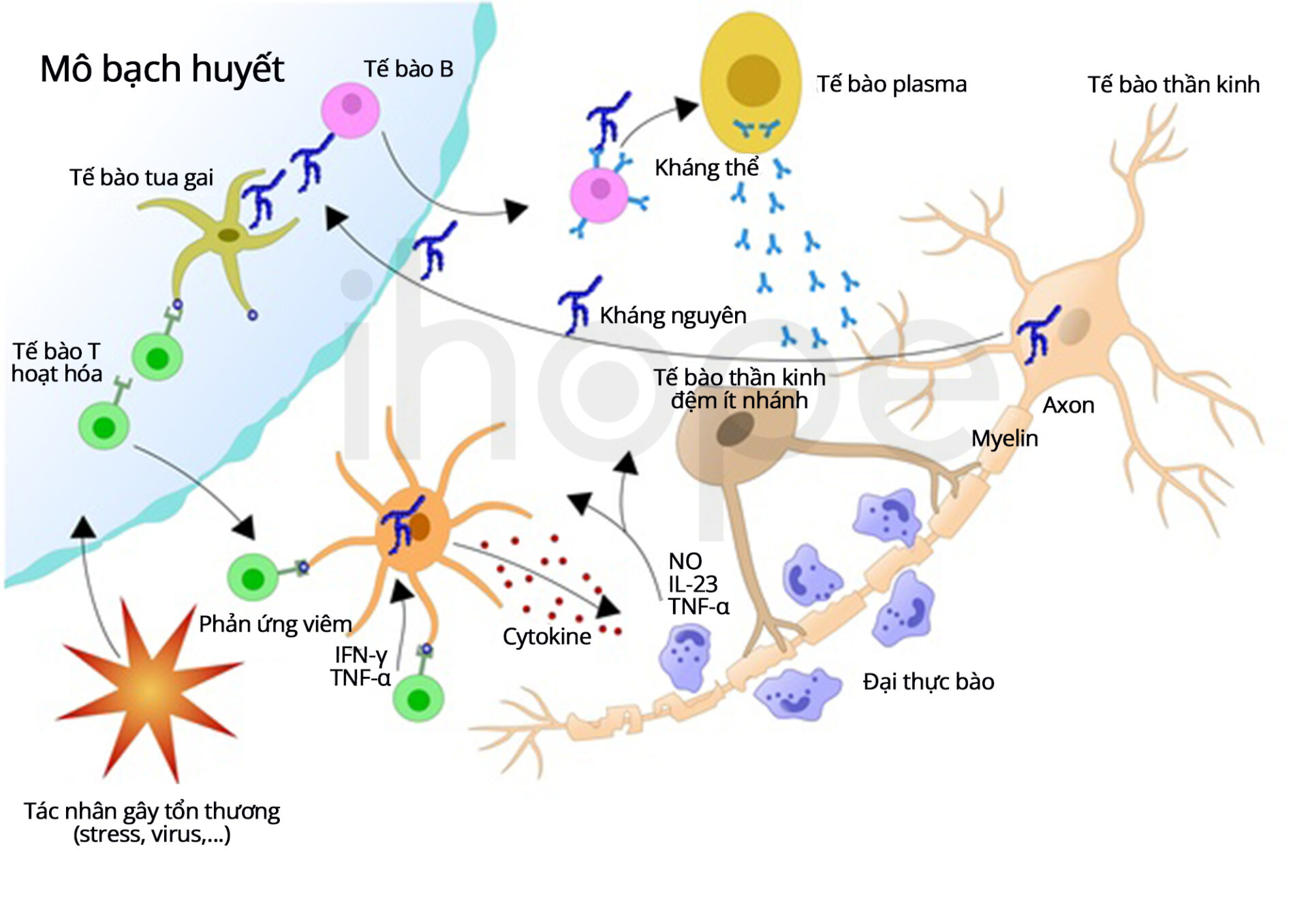 Phản ứng Tự Miễn Hình Thành Bệnh đa Xơ Cứng