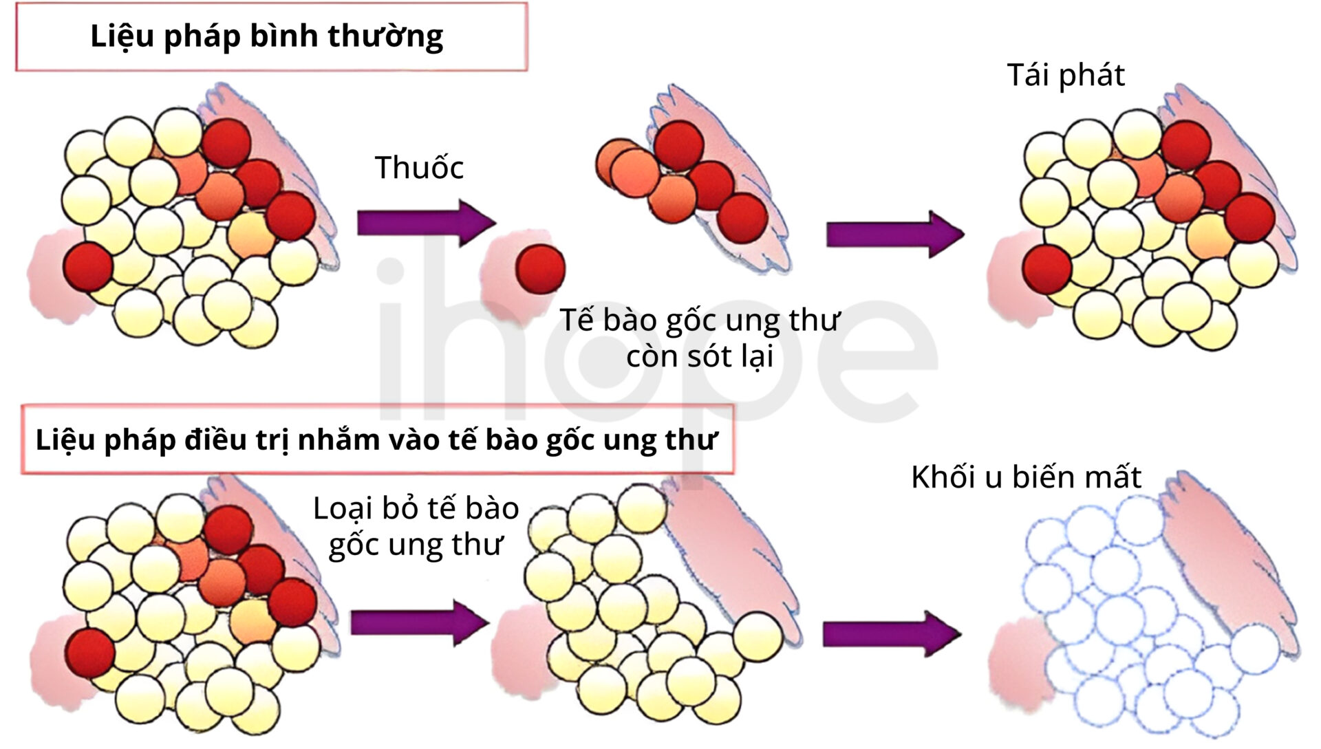 Liệu Pháp Nhắm Tế Bào Gốc Ung Thư (1)