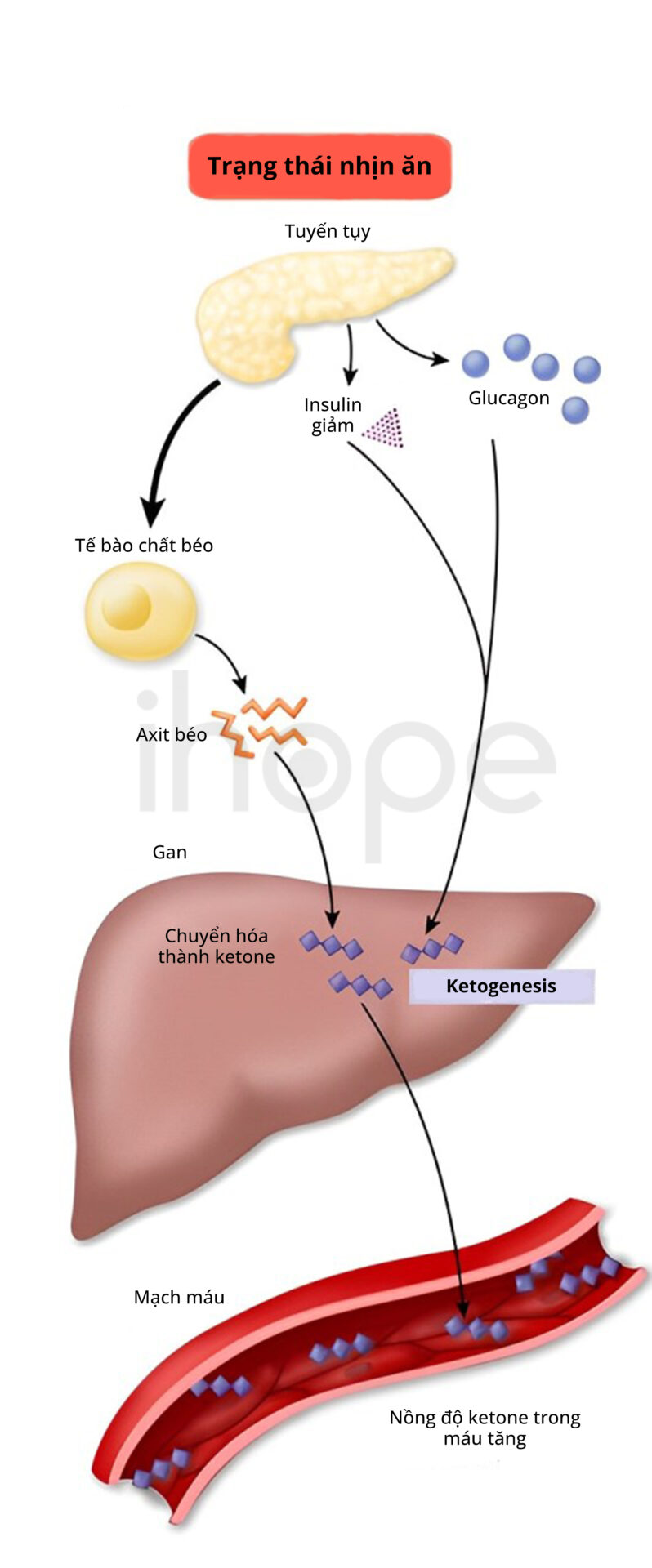 Phân Hủy Chất Béo Tạo Ketone Trong Gan (1)
