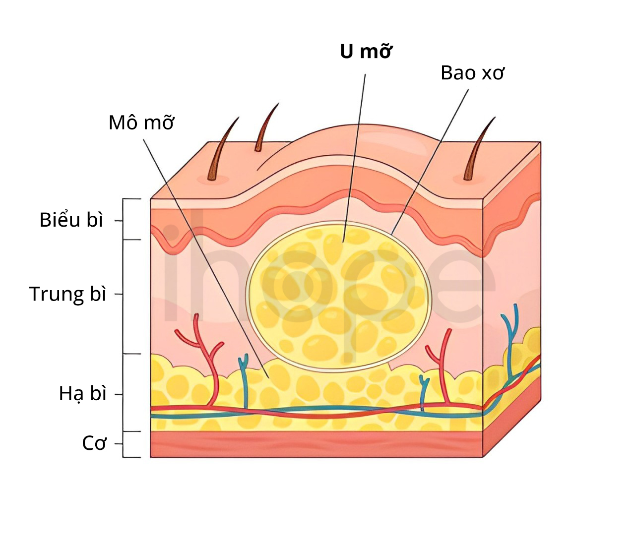 U Mỡ (1)