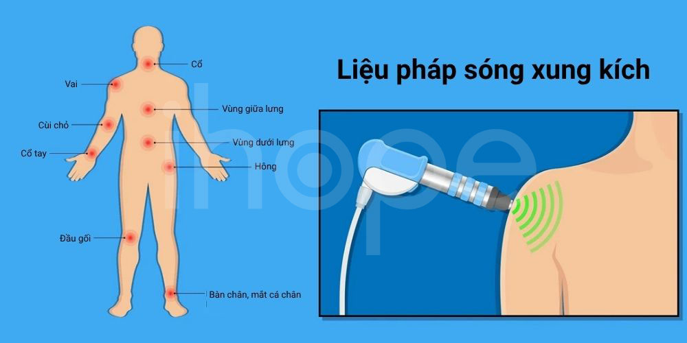 Liệu pháp sóng xung kích