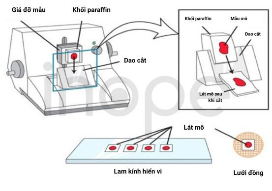 Kỹ thuật cắt khối mô thành các lát mỏng