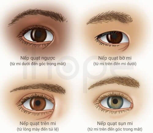 Các dạng nếp quạt