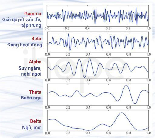 Các dạng sóng não