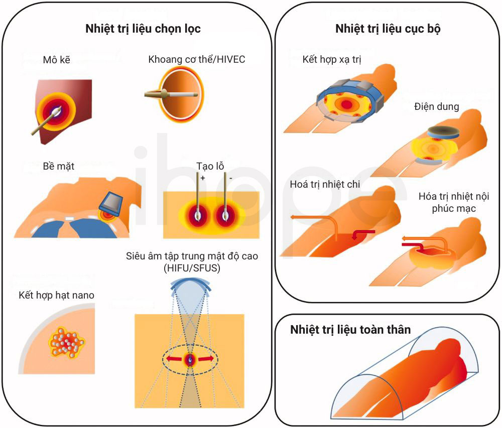 Các kỹ thuật nhiệt trị liệu