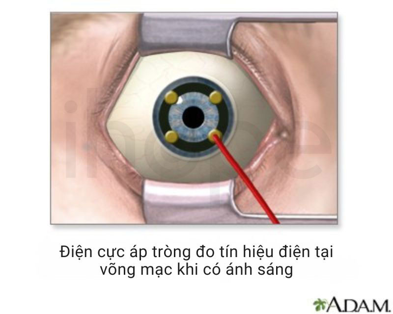 Dien-co-mat