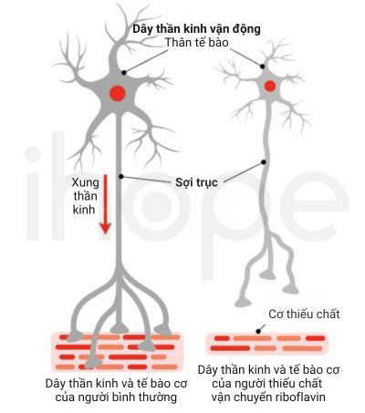 Hoạt động thần kinh thiếu chất vận chuyển riboflavin