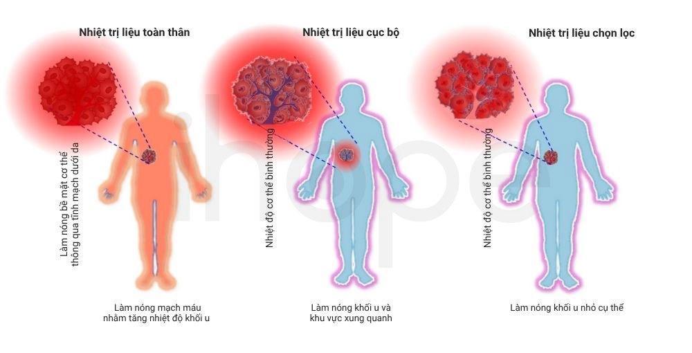 Nguyên lí các phương pháp nhiệt trị liệu