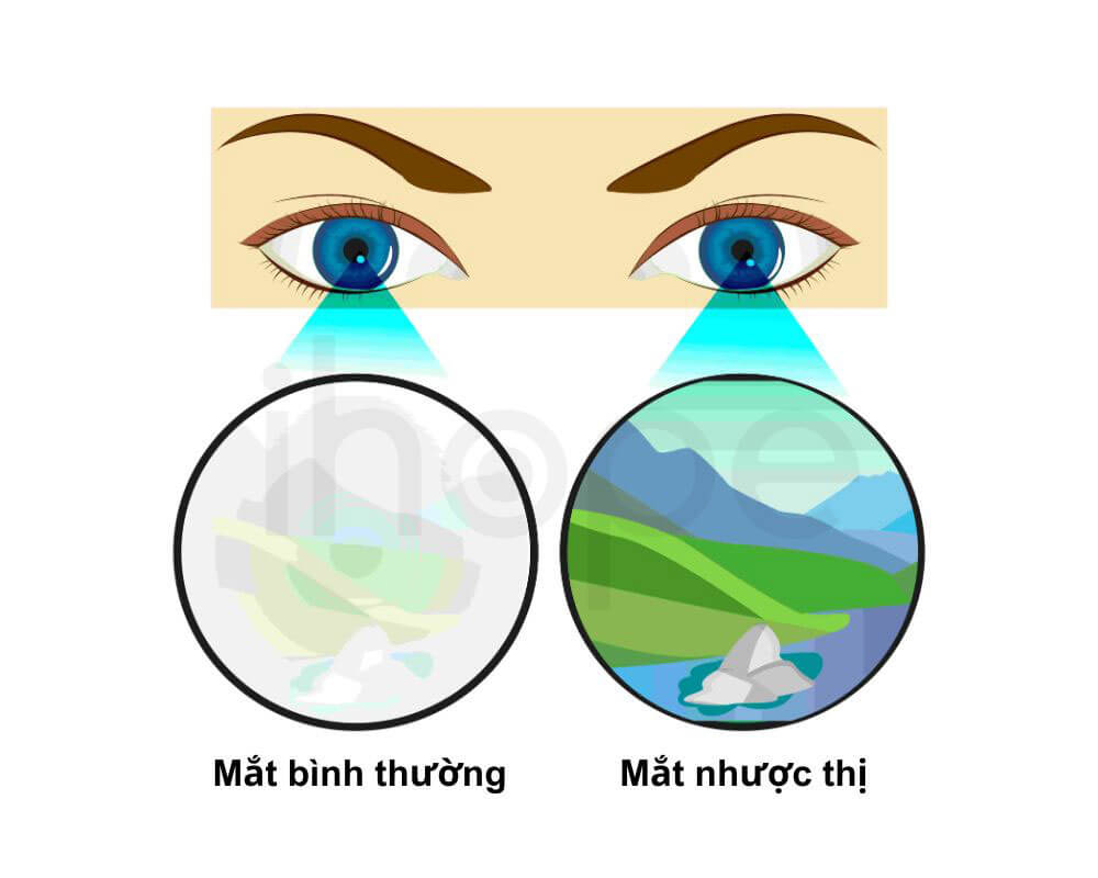 Nhược thị