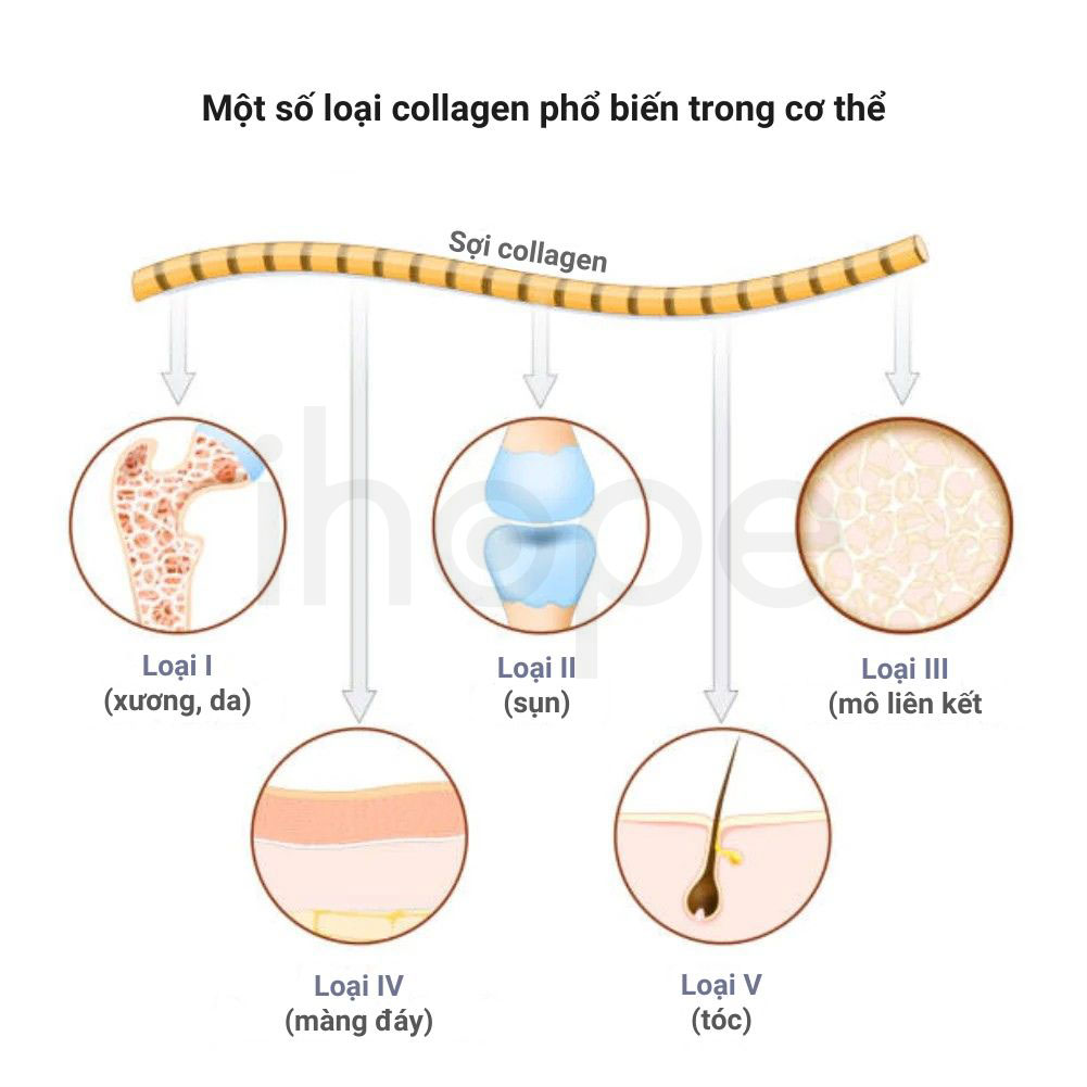 Một số loại collagen phổ biến trong cơ thể