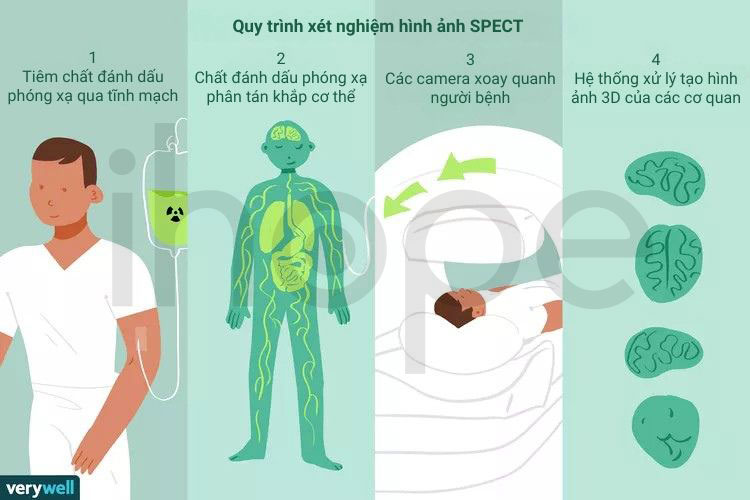 Quy trình xét nghiệm hình ảnh spect