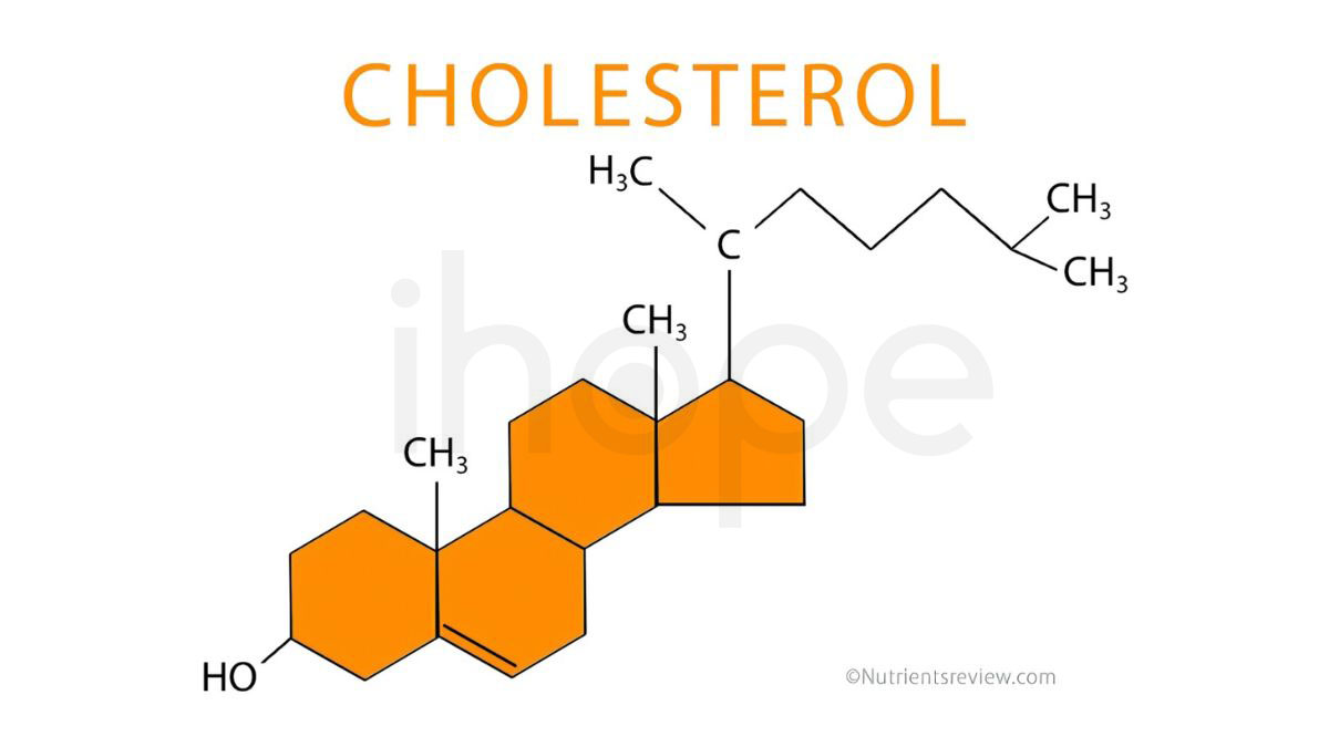 Cholesterol