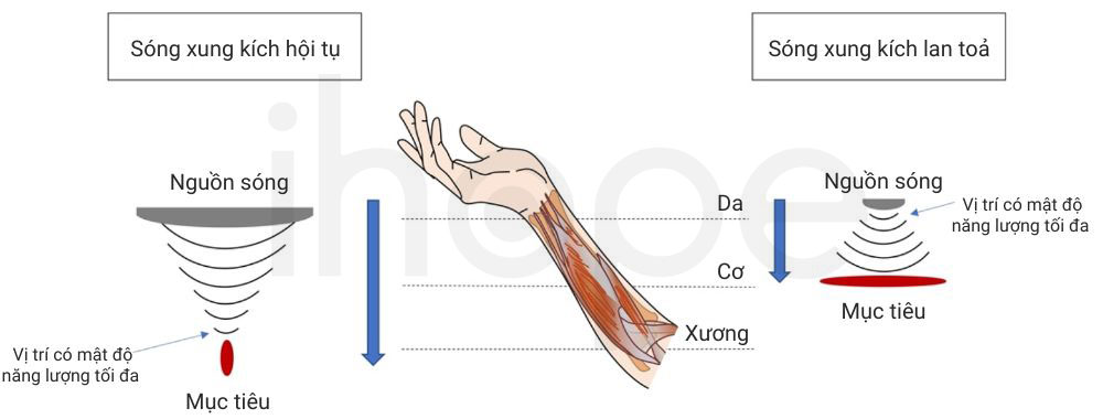 So sánh sóng xung kích hội tụ và lan toả